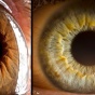 Фотографии человеческого глаза, которые Вас шокируют