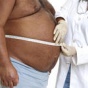 Ожирение вылечат пересадкой жира