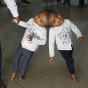 Невероятная история сросшихся головами близнецов (ФОТО)