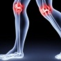 Несколько рецептов, которые помогут при боли в коленях