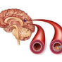 Лікарі відповіли, що таке атеросклероз і як йому запобігти