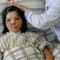 Китайские врачи сделали новое лицо девушке из ее груди (ФОТО)