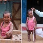 Феномен 50-летнего индийца, который перестал расти в возрасте 5-лет (ФОТО)