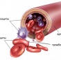 Диабет вылечат «исправлением» крови