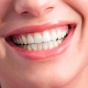 Уход за зубами: несколько полезных рекомендаций
