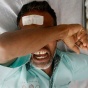 Врач перепутал пациентов и продырявил ногу индийцу с травмой головы