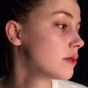 Эмбер Херд показала новые фотографии, сделанные после избиения