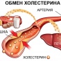 Как снизить уровень холестерина без лекарств