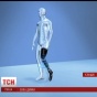 Ісландські медики винайшли технологію протезування, яка ставитиме людей на ноги за 10 хвилин