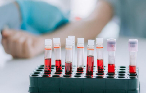 аналіз крові