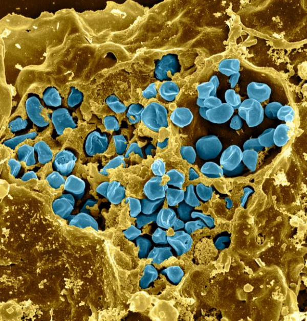 Бактерии рода Francisella маскируются от иммунитета с помощью собственной противовирусной защиты. (Фото <noindex><a target=_blank href=