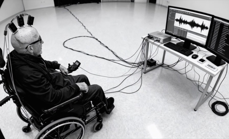 Мозковий імплантат: Siggy