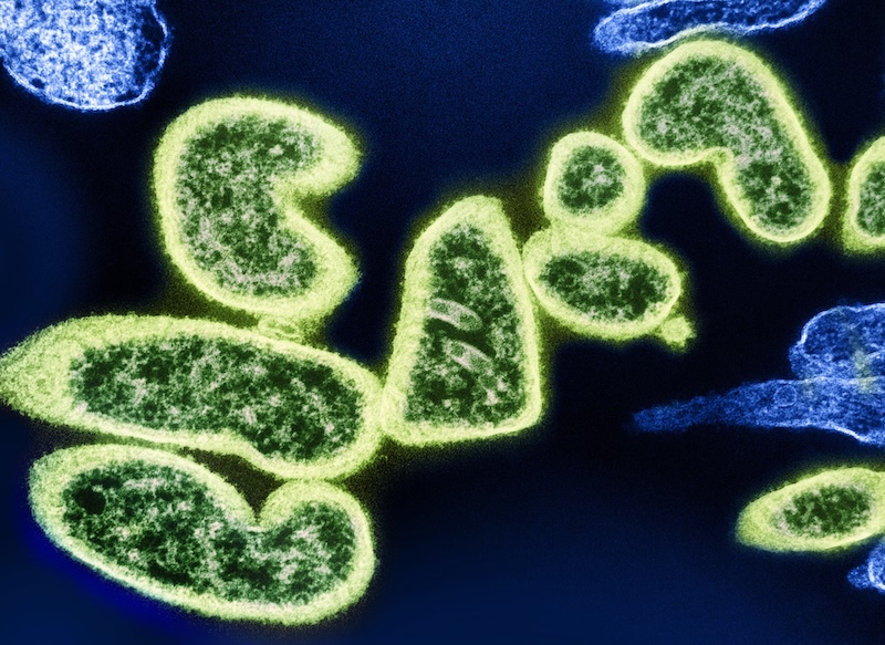 Источник изображения: National Institute of Allergy and Infectious Diseases/Unsplash