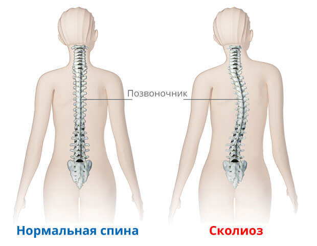 Узнайте, ЧТО нужно лечить про проблемах со спиной