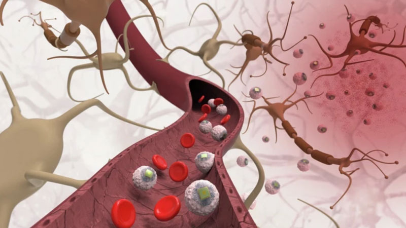 Чипи та нейронні мережі: MIT